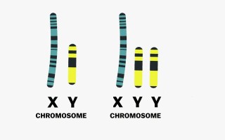 xyy染色体的名人(xy染色体是谁命名的)