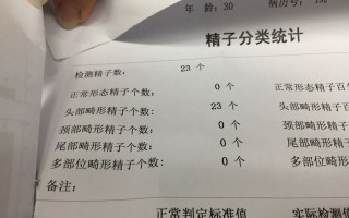 试管婴儿的具体步骤百度百科的简单介绍