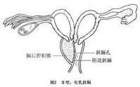 男女胎儿生殖器生长(胎儿男女生殖图区别图b超下)