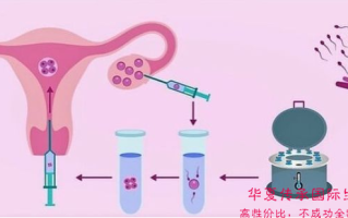 试管婴儿和人工授精的婴儿有区别吗(试管婴儿和人工授精的区别都是夫妻两亲生的吗)