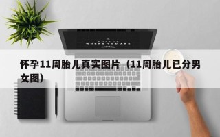 怀孕11周胎儿真实图片（11周胎儿已分男女图）
