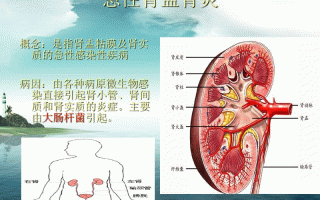 肾炎(肾炎的初期症状是什么样的)