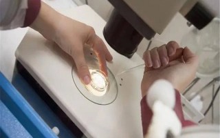 国外做试管婴儿要怎么做呀(国外做试管婴儿要怎么做呀多少钱)