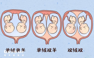 试管同卵双胞胎的危害(试管异卵双胞胎什么性别多)