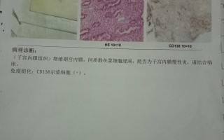 子宫息肉复发很快怎么做试管成功率高(子宫息肉复发很快怎么做试管成功率高呢)