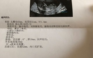 试管婴儿做nt是查什么的简单介绍