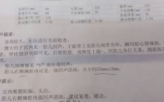 孕期羊水指数对照表(孕期羊水指数对照表29周)