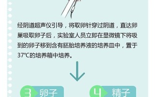 试管婴儿是因为什么(试管婴儿是因为什么导致的)