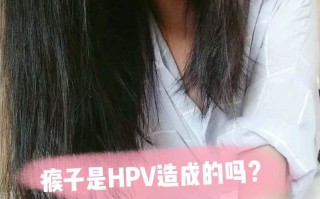 男女都健康就不会得hpv吗知乎(男女都健康就不会得hpv吗知乎文章)