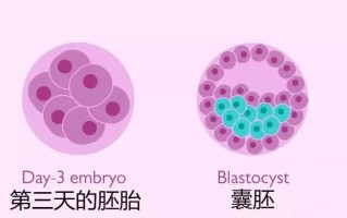 什么是一到三代试管婴儿(试管婴儿一代三代什么意思)