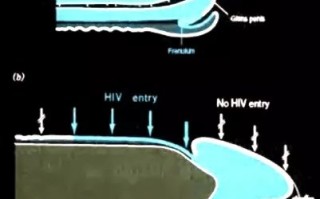 男女生殖器长溃疡的简单介绍