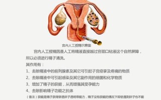 试管婴儿与人工授精区别(试管婴儿与人工授精区别大吗)