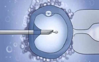 48岁做试管成功率多少(48岁做试管婴儿采用什么方案好)