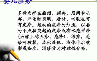 婴儿湿疹治疗(婴儿湿疹治疗方法有哪些)