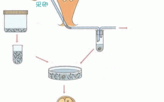 试管人流怎么做(试管人流怎么做过程)