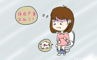 孕妇痔疮犯了怎么办(孕妇痔疮犯了怎么办?特别疼)