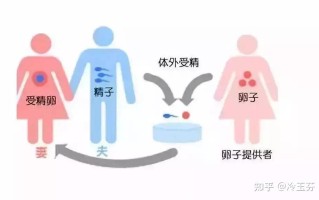 什么是第三方试管婴儿(什么是第三方试管婴儿手术)