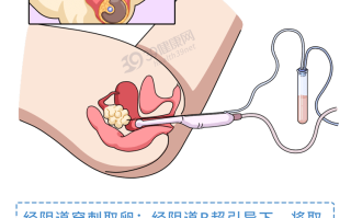 试管婴儿怎么做的全过程新闻(试管婴儿怎么做的全过程 新闻)