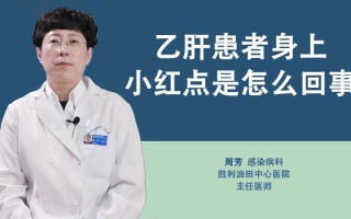 乙肝症状(乙肝症状表现有哪些男性)